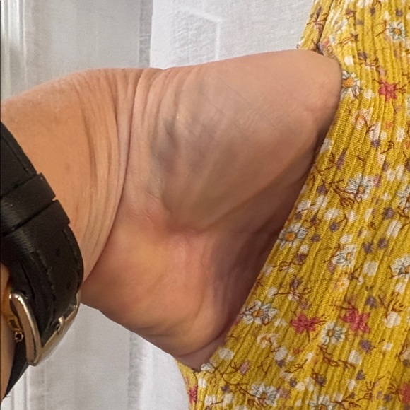 Easel Floral V-Neck Mini Dress in Yellow - Picture 3 of 5